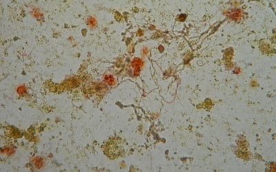 REMOCIÓN DE HIERRO Y MANGANESO MEDIANTE BIOFILTRACIÓN