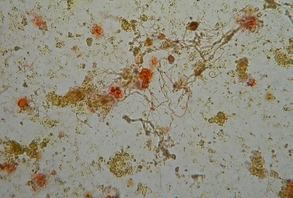 REMOCIÓN DE HIERRO Y MANGANESO MEDIANTE BIOFILTRACIÓN