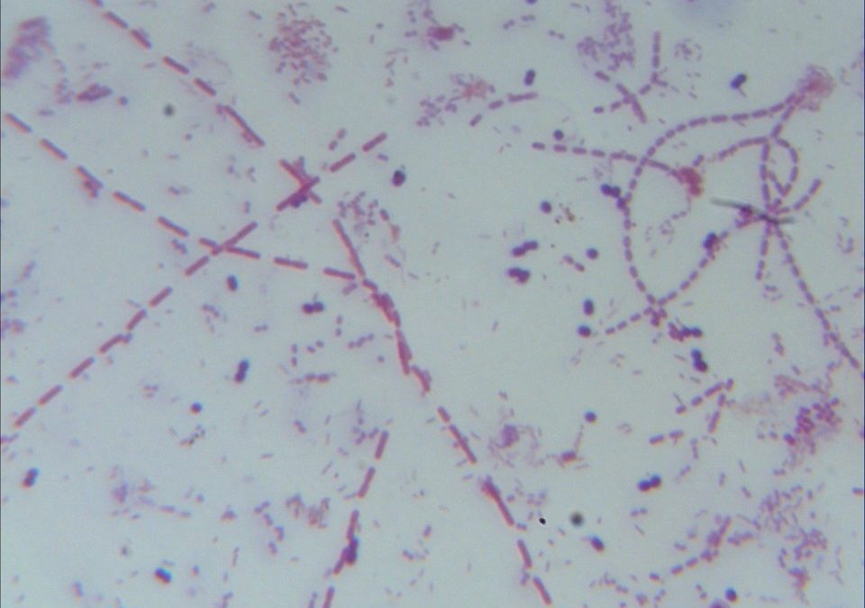 REMOCIÓN DE HIERRO Y MANGANESO MEDIANTE BIOFILTRACIÓN.